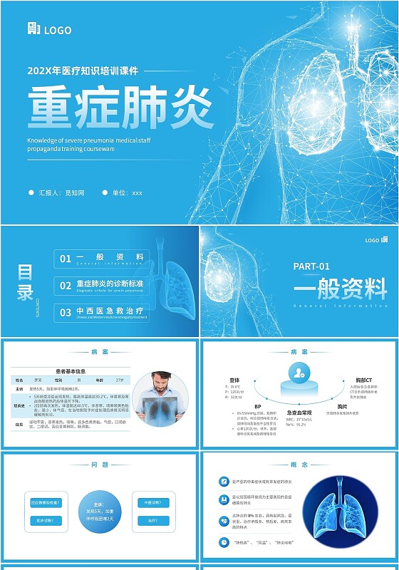 蓝色简约科技风重症肺炎医疗知识宣传PPT课件肺结核肺结节