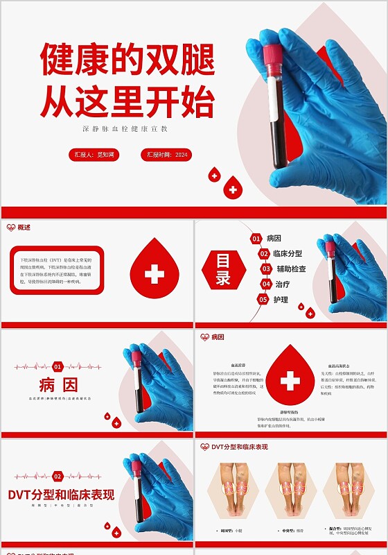 红色简约深静脉血栓健康宣教PPT模板深静脉血栓的护理查房