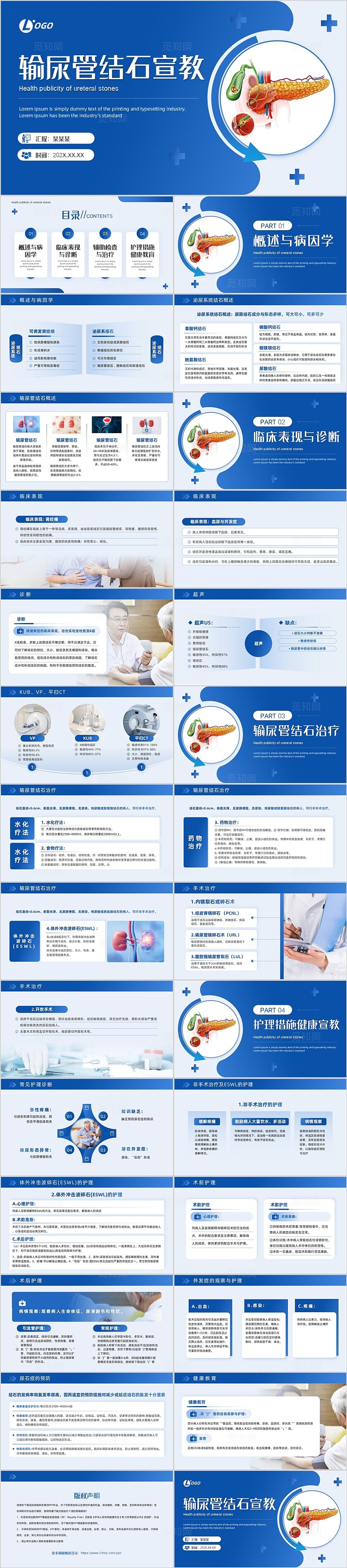 蓝色简约风输尿管结石健康宣教PPT模板护理查房个案护理