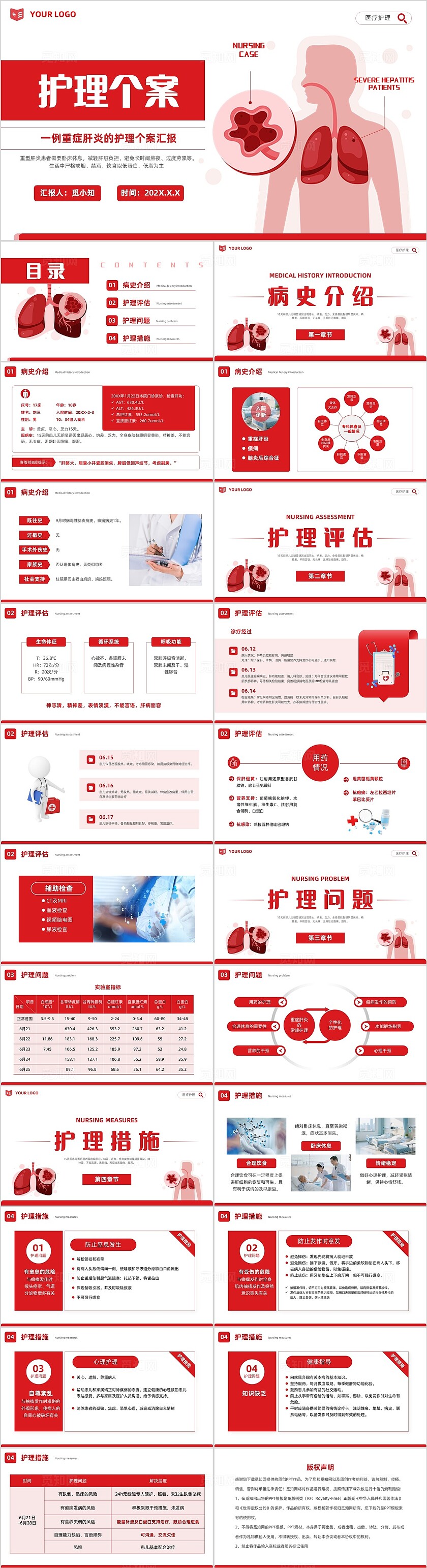 简约红色插画重症肝炎护理个案医疗健康护理培训PPT模版护理查房