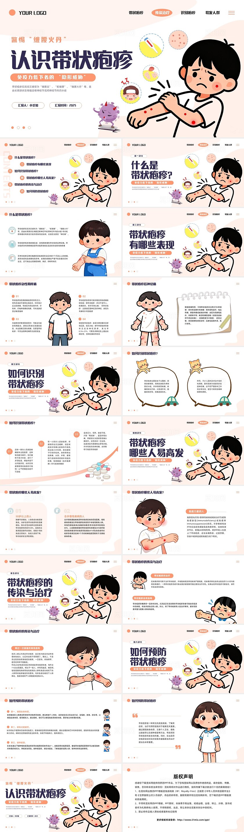 橙色插画卡通带状疱疹PPT模板宣传PPT动态PPT健康管理医疗预防传染病
