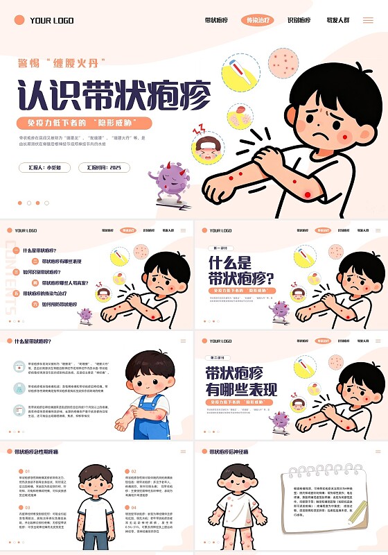 橙色插画卡通带状疱疹PPT模板宣传PPT动态PPT健康管理医疗预防传染病