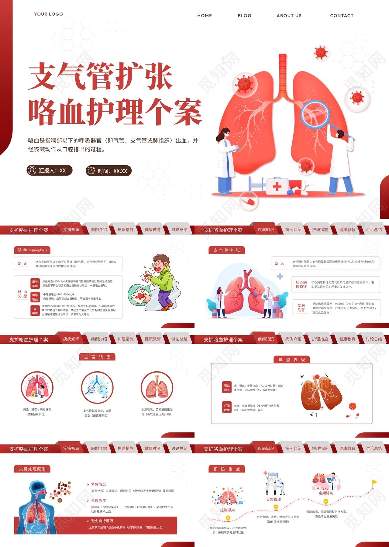 红色渐变简约插画医疗医护护理培训支气管扩张咯血护理个案PPT医学医疗护理查房